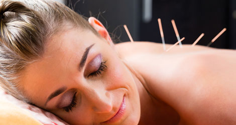 Acupuncture Treatment